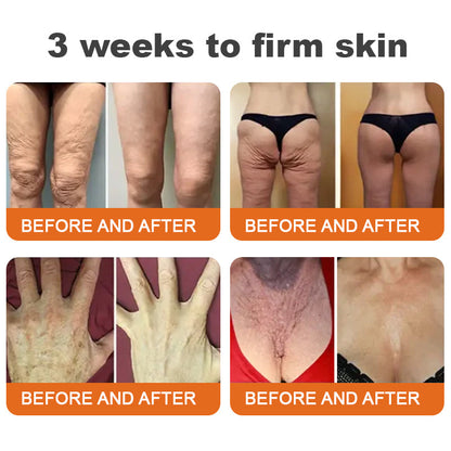 🐝FDA Approved: ODALIT™ Bee venom Pro Comprehensive Cream — 🔥Limited Time 80% OFF🔥
