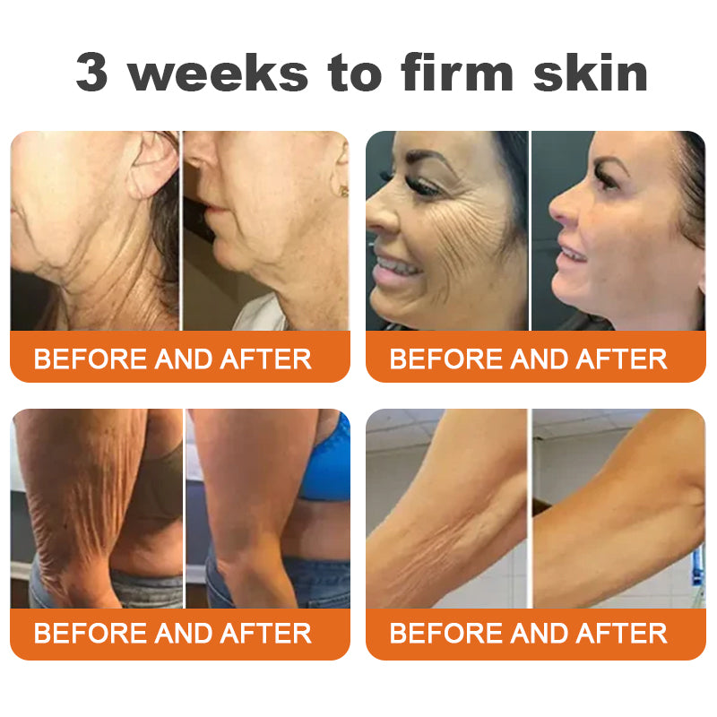 🐝FDA Approved: ODALIT™ Bee venom Pro Comprehensive Cream — 🔥Limited Time 80% OFF🔥