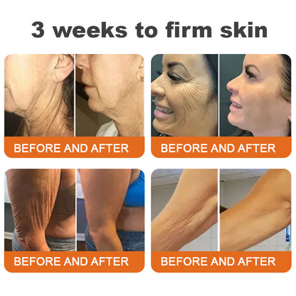 🐝FDA Approved: ODALIT™ Bee venom Pro Comprehensive Cream — 🔥Limited Time 80% OFF🔥