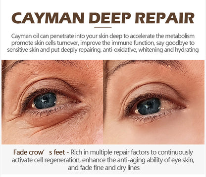 JEREMYTIS™Instant dark circles/eye wrinkles eye cream