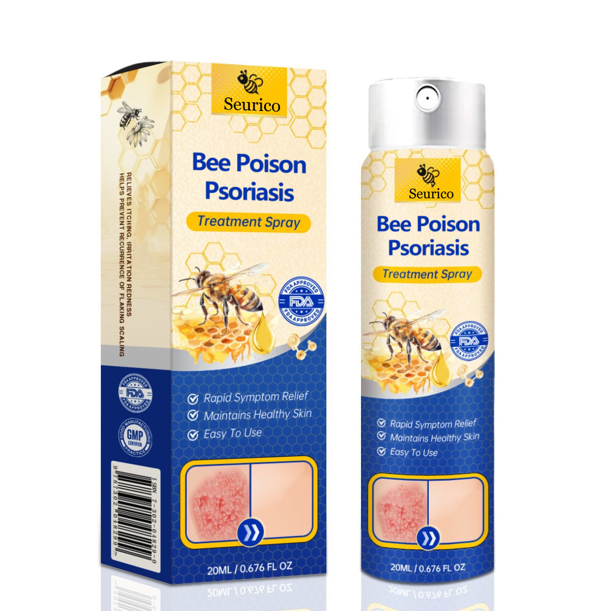 ✨【 official  Brand  Store】  Last Day Discount: 83% OFF 🌸 Seurico™ PsoriaHeal  psoriasis Spray pro
