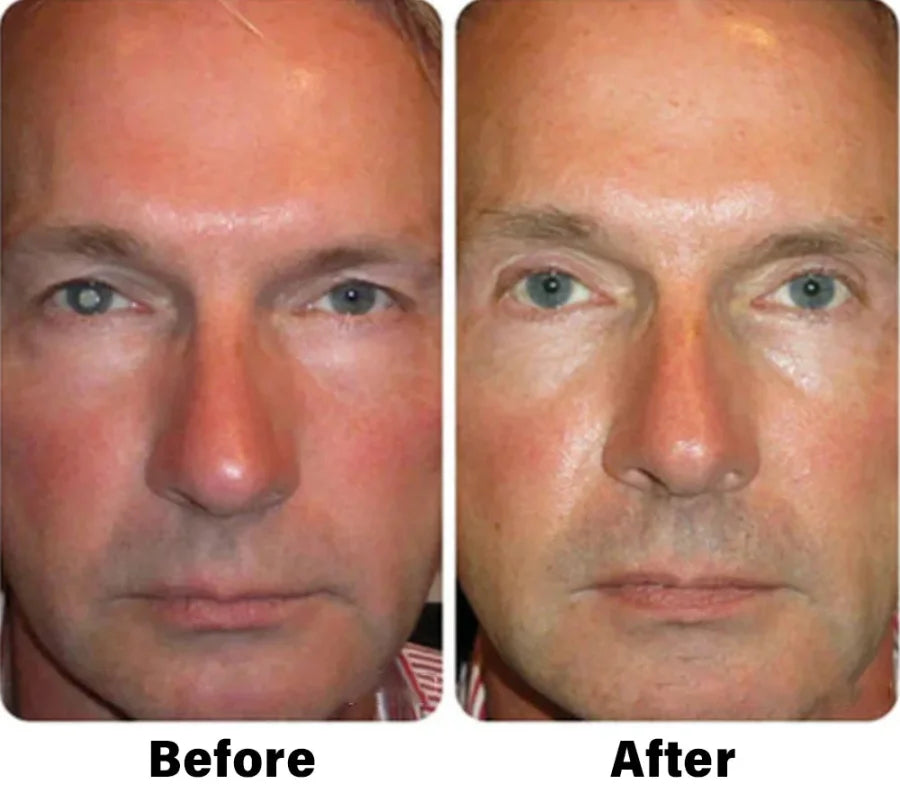 NEGUSY™ Nano Vision Repair Eye Serum ✅FDA Approved(Suitable for presbyopia, dry eye syndrome, glaucoma, and cataracts)