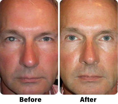 NEGUSY™ Nano Vision Repair Eye Serum ✅FDA Approved(Suitable for presbyopia, dry eye syndrome, glaucoma, and cataracts)