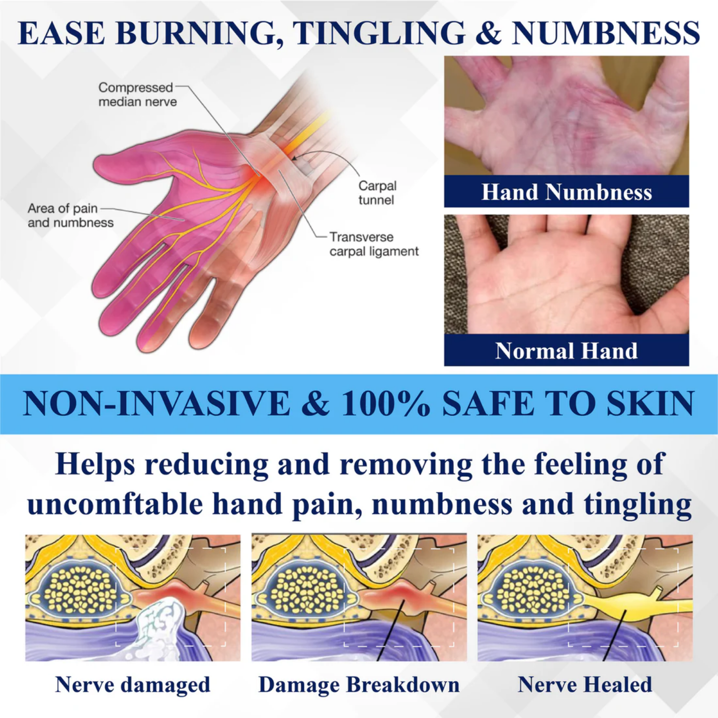 ODALIT™NerveRelief LC Medical Treatment Cream