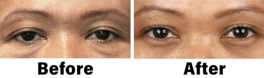 NEGUSY™ Nano Vision Repair Eye Serum ✅FDA Approved(Suitable for presbyopia, dry eye syndrome, glaucoma, and cataracts)