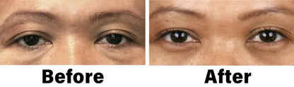 NEGUSY™ Nano Vision Repair Eye Serum ✅FDA Approved(Suitable for presbyopia, dry eye syndrome, glaucoma, and cataracts)