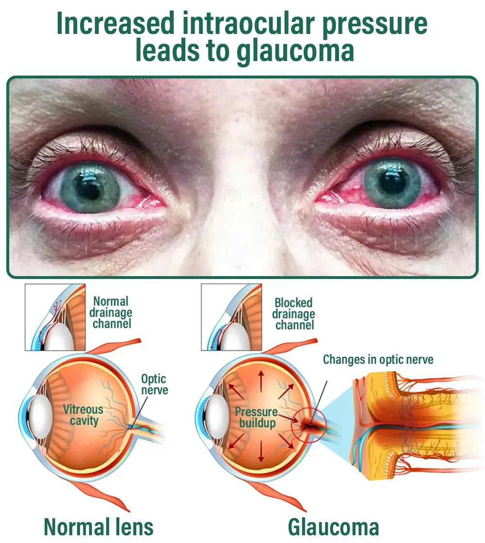 NEGUSY™ Nano Vision Repair Eye Serum ✅FDA Approved(Suitable for presbyopia, dry eye syndrome, glaucoma, and cataracts)