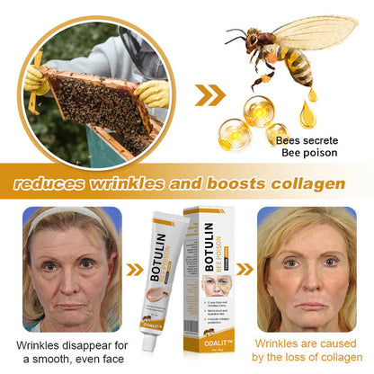 ODALIT™ Botulin Bee Poison Wrinkle Removal Cream