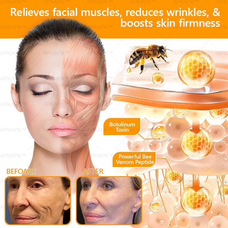 🐝FDA Approved: ODALIT™ Bee venom Pro Comprehensive Cream — 🔥Limited Time 80% OFF🔥