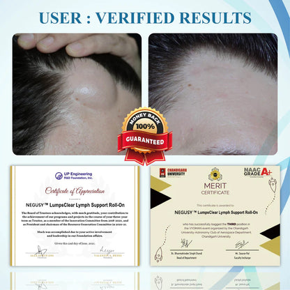 NEGUSY™ LumpsClear Lymph Support Roll-On