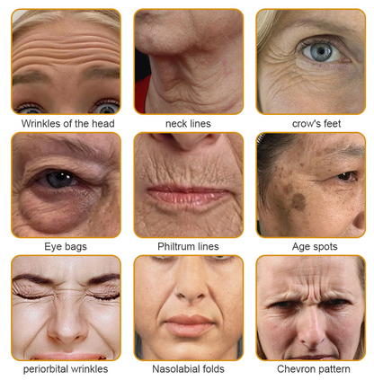 ODALIT™ Botulin Bee Poison Wrinkle Removal Cream