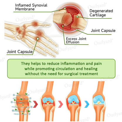 ODALIT™ Magnesium & Peppermint Arthritis Pain Relief and Bone Healing Cream
