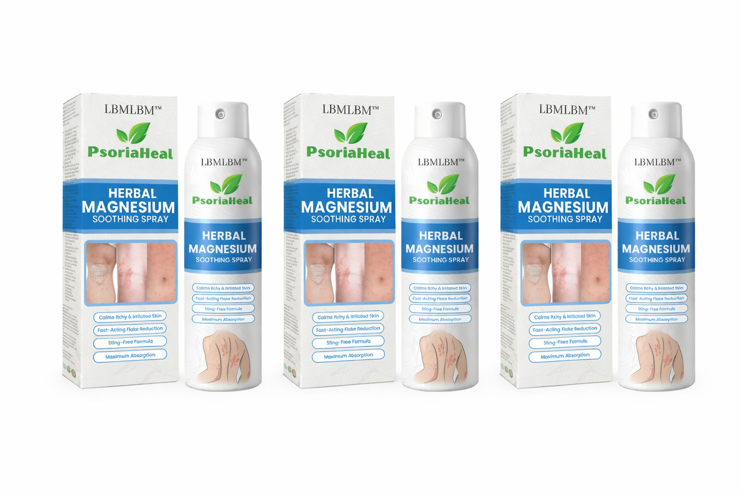 🆙🌿LBMLBM™ PsoriaHeal Herbal Magnesium Soothing Spray