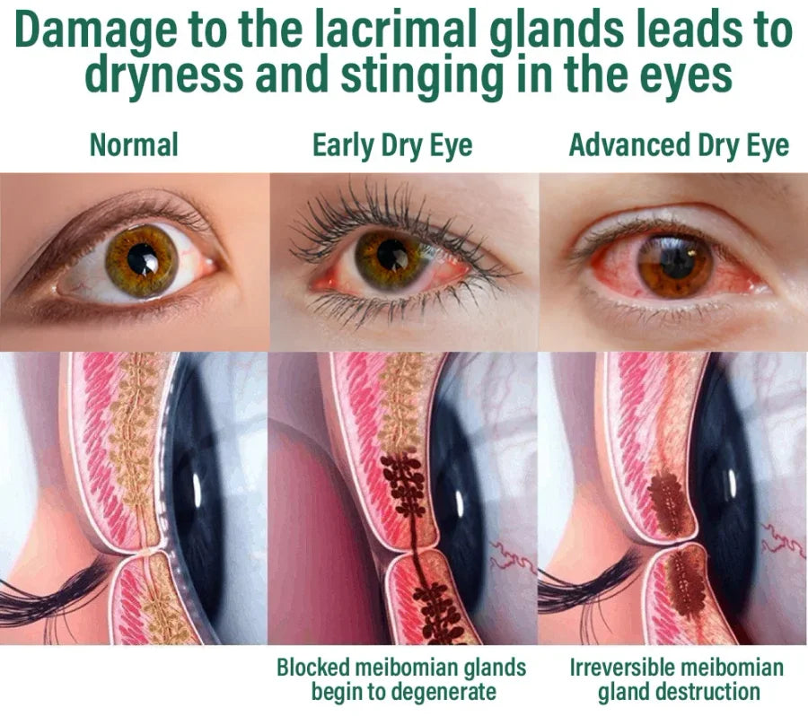 NEGUSY™ Nano Vision Repair Eye Serum ✅FDA Approved(Suitable for presbyopia, dry eye syndrome, glaucoma, and cataracts)