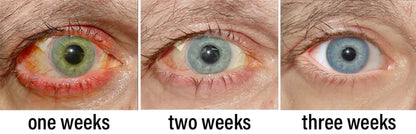 NEGUSY™ Nano Vision Repair Eye Serum ✅FDA Approved(Suitable for presbyopia, dry eye syndrome, glaucoma, and cataracts)