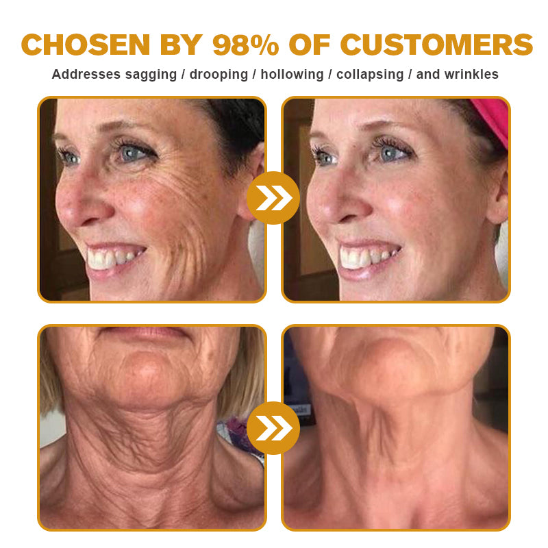 ODALIT™ Botulin Bee Poison Wrinkle Removal Cream