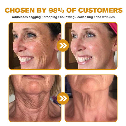 ODALIT™ Botulin Bee Poison Wrinkle Removal Cream