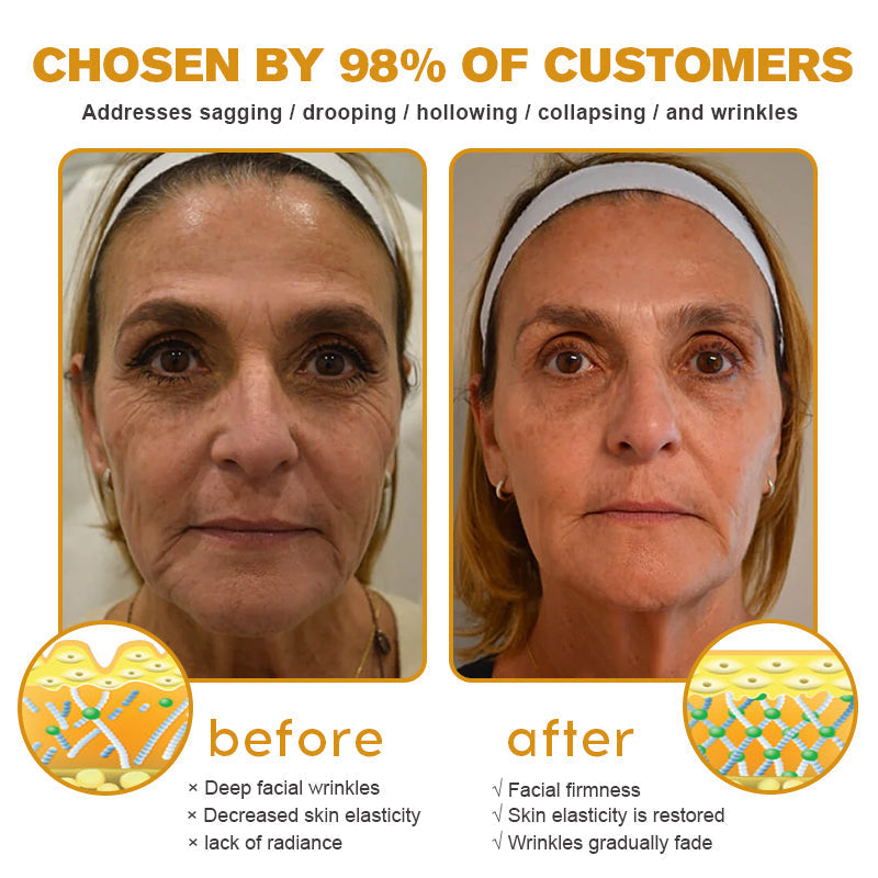 ODALIT™ Botulin Bee Poison Wrinkle Removal Cream