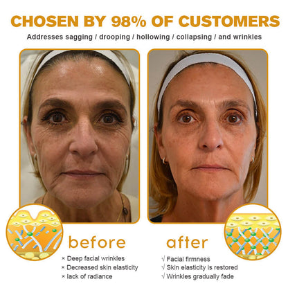ODALIT™ Botulin Bee Poison Wrinkle Removal Cream